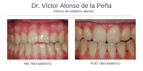 clinica-estetica-dental-galicia-trauma-tres