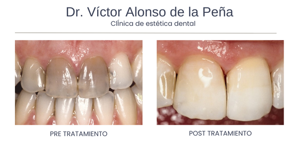 clinica-estetica-dental-galicia-vitales-dos