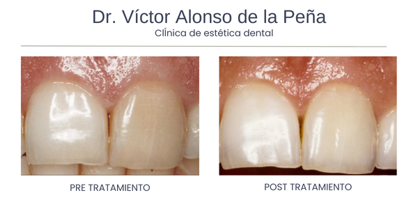 clinica-estetica-dental-galicia-vitales-tres