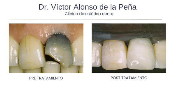 clinica-estetica-dental-galicia-vitales-uno