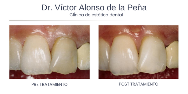 clinica-estetica-dental-galicia-vitales-cuatro