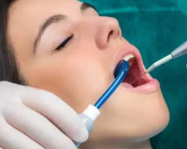 dentista-santiago-de-compostela-higiene