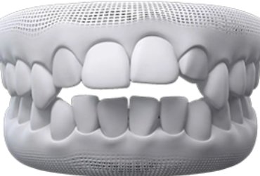 invisalign-santiago-de-compostela-abierta