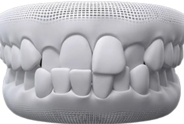 invisalign-santiago-de-compostela-cruzada