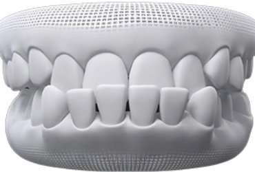 invisalign-santiago-de-compostela-prognatismo