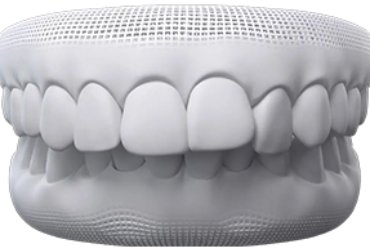 invisalign-santiago-de-compostela-sobremordida